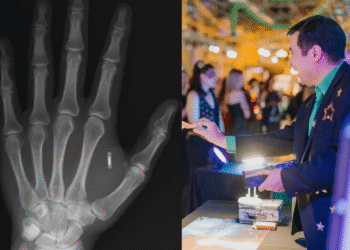 «Забыл пароль от собственной руки»: фокусник имплантировал RFID-чип, а потом потерял к нему доступ